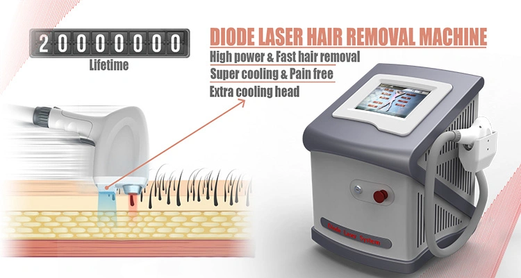 755nm 810nm 1064nm Fast Hair Removal Laser Diode Laser
